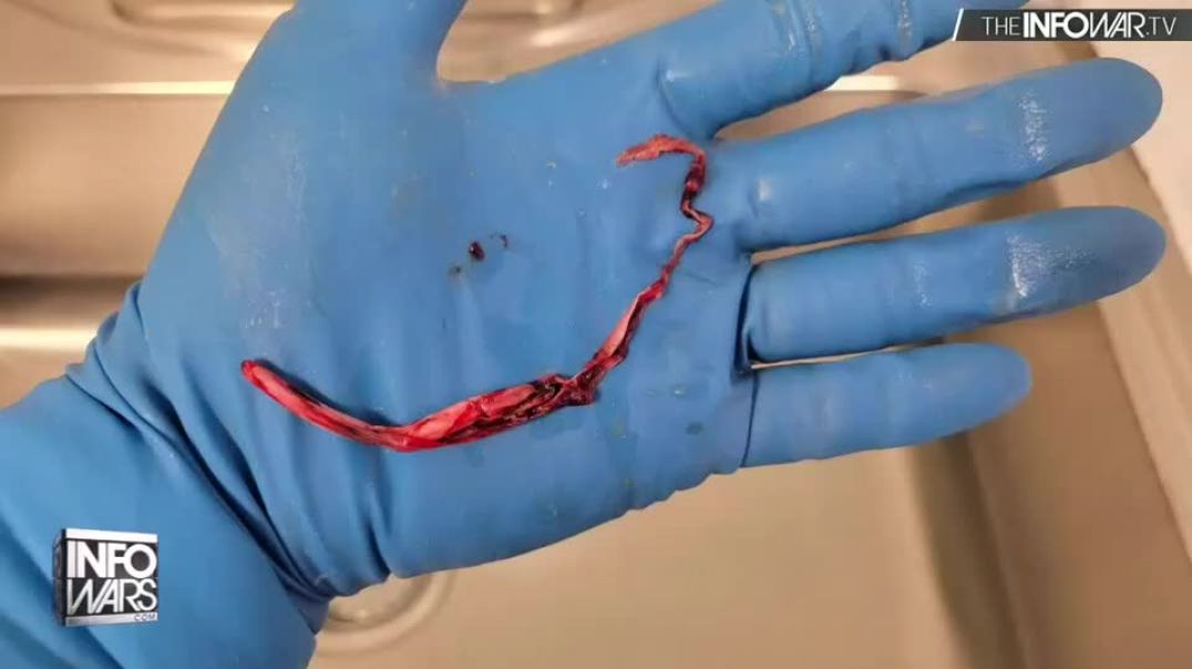 MIKE ADAMS PART:2  FINDS ALIEN TISSUES IN VACCINE DEAD