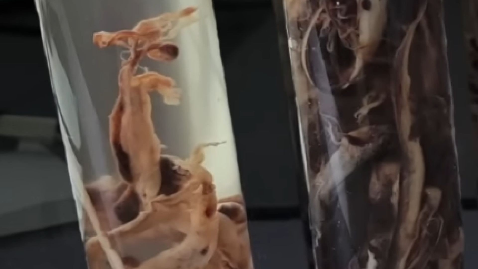 Mystery clots - Jan 19, 2023 -
