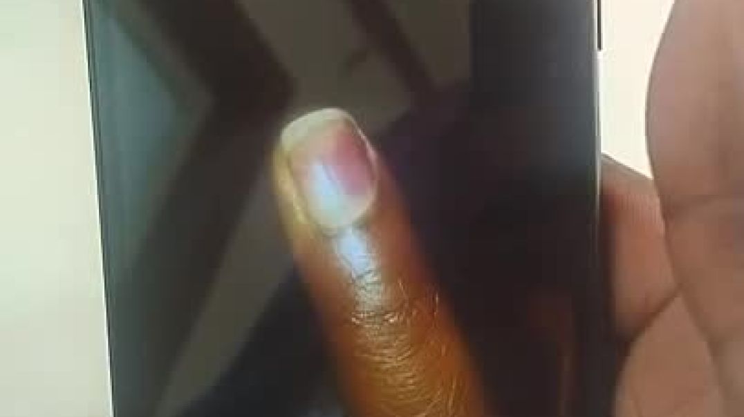 A healing testimony  garage door accident  didn't lose my finger nail! Hallelujah!